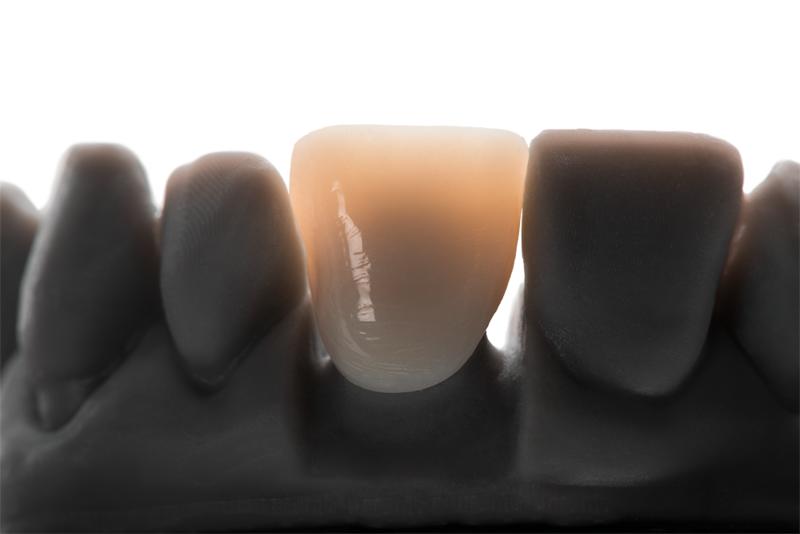 VarseoSmile TriniQ A3